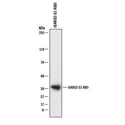 SARS-CoV-2 Spike RBD Antibody, R D Systems 25 &mu;g; Unconjugated:Anticuerpos