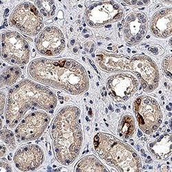 Human TIM-1/KIM-1/HAVCR Antibody, R D Systems:Antibodies:Primary Antibodies