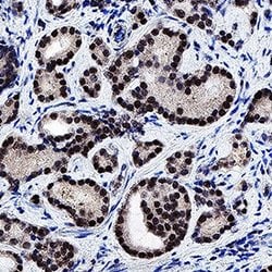 Human Androgen R/NR3C4 Antibody, R D Systems:Antibodies:Primary Antibodies