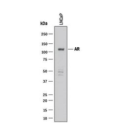 Human Androgen R/NR3C4 Antibody, R D Systems:Antibodies:Primary Antibodies