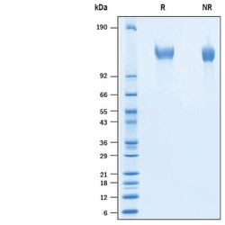 R&D Systems&trade;&nbsp;Recombinant Cynomolgus CD96 His-tag Protein