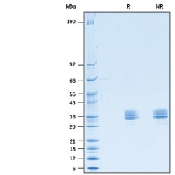 R&D Systems&trade;&nbsp;Recombinant Mouse Mesothelin (aa 36-288) His-tag Protein