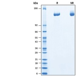 R&D Systems&trade;&nbsp;Recombinant Human Plexin A3 His-tag Protein