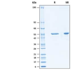 R&D Systems&trade;&nbsp;Recombinant MERS-CoV Nucleocapsid His-tag Protein