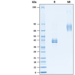R D Systems Recombinant Cynomolgus Monkey Ly6E Fc Chimera Protein 50 &mu;g | Buy Online | R&amp;D Systems&trade; | Fisher Scientific