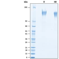 R&D Systems&trade;&nbsp;Recombinant Human SSc5D His-tag Protein