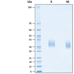 R&D Systems&trade;&nbsp;Recombinant SARS-CoV Spike RBD His-tag Protein