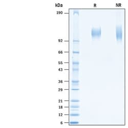 R D Systems Recombinant SARS-CoV-2 Spike S1 Subunit His-tag Protein 100
