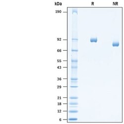 R&D Systems&trade;&nbsp;Recombinant SARS-CoV Spike S1 Subunit His-tag Protein