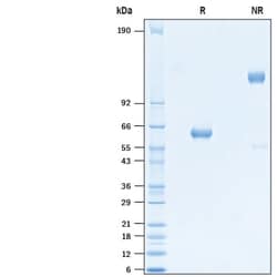 R D Systems Recombinant SARS-CoV Spike RBD Fc Chimera Protein 100 &mu;g | Buy Online | R&amp;D Systems&trade; | Fisher Scientific