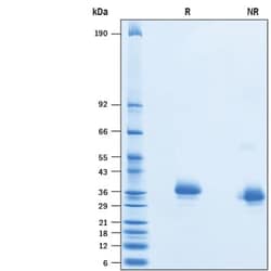 R&D Systems&trade;&nbsp;Recombinant SARS-CoV Spike RBD His-tag Protein