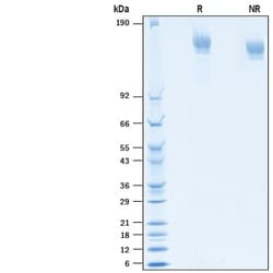R&D Systems&trade;&nbsp;Recombinant SARS-CoV-2 D614G Spike His-tag, Protein CF