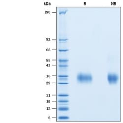 R&D Systems&trade;&nbsp;Recombinant HCoV-NL63 Spike RBD His-tag Protein