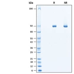 R&D Systems&trade;&nbsp;Recombinant SARS-CoV-2 NSP12 His-tag Protein