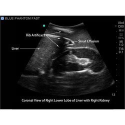 3B Scientific Blue Phantom FAST, TEE and TTE Training Model Ultrasound Training; Includes: Microfiber Cleaning Towel, Powder, Syringes, and Ultrasound Fluid | Buy Online | 3B Scientific&trade; | Fisher Scientific