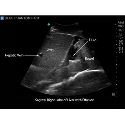 3B Scientific Blue Phantom FAST, TEE and TTE Training Model Ultrasound Training; Includes: Microfiber Cleaning Towel, Powder, Syringes, and Ultrasound Fluid | Buy Online | 3B Scientific&trade; | Fisher Scientific