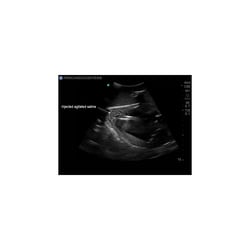 3B Scientific Blue Phantom Transthoracic Echocardiography and Pericardiocentesis Ultrasound Training Model Training Model; For Use With: Transthoracic Echocardiography and Pericardiocentesis Training | Buy Online | 3B Scientific&trade; | Fisher Scientific