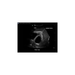 3B Scientific Blue Phantom Transthoracic Echocardiography and Pericardiocentesis Ultrasound Training Model Training Model; For Use With: Transthoracic Echocardiography and Pericardiocentesis Training | Buy Online | 3B Scientific&trade; | Fisher Scientific