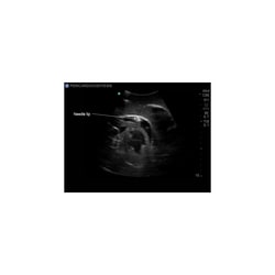 3B Scientific Blue Phantom Transthoracic Echocardiography and Pericardiocentesis Ultrasound Training Model Training Model; For Use With: Transthoracic Echocardiography and Pericardiocentesis Training | Buy Online | 3B Scientific&trade; | Fisher Scientific