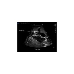 3B Scientific Blue Phantom Transthoracic Echocardiography and Pericardiocentesis Ultrasound Training Model Training Model; For Use With: Transthoracic Echocardiography and Pericardiocentesis Training | Buy Online | 3B Scientific&trade; | Fisher Scientific