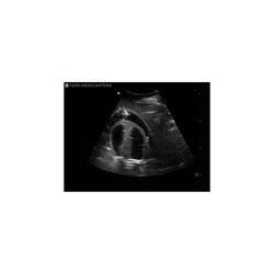 3B Scientific Blue Phantom Transthoracic Echocardiography and Pericardiocentesis Ultrasound Training Model Training Model; For Use With: Transthoracic Echocardiography and Pericardiocentesis Training | Buy Online | 3B Scientific&trade; | Fisher Scientific