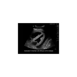 3B Scientific Blue Phantom Transthoracic Echocardiography and Pericardiocentesis Ultrasound Training Model Training Model; For Use With: Transthoracic Echocardiography and Pericardiocentesis Training | Buy Online | 3B Scientific&trade; | Fisher Scientific