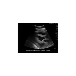 3B Scientific Blue Phantom Transthoracic Echocardiography and Pericardiocentesis Ultrasound Training Model Training Model; For Use With: Transthoracic Echocardiography and Pericardiocentesis Training | Buy Online | 3B Scientific&trade; | Fisher Scientific
