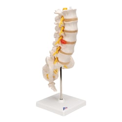 3B Scientific Lumbar Spinal Column Model - includes 3B Smart Anatomy Lumbar