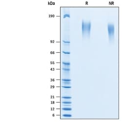 R&D Systems&trade;&nbsp;Recombinant Human CEACAM-5/CD66e His-tag Avi-tag Protein