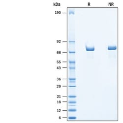 R&D Systems&trade;&nbsp;Recombinant Human Chromogranin A His-tag Protein