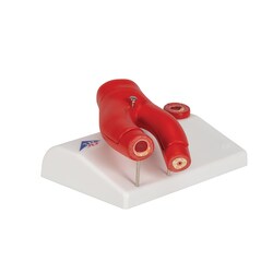 3B Scientific Arteriosclerosis Model with Cross Section of Artery 5.5 x 3.9 x 2.8 in. | Buy Online | 3B Scientific&trade; | Fisher Scientific