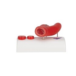 3B Scientific Arteriosclerosis Model with Cross Section of Artery 5.5 x 3.9 x 2.8 in. | Buy Online | 3B Scientific&trade; | Fisher Scientific