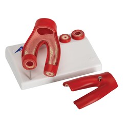 3B Scientific Arteriosclerosis Model with Cross Section of Artery 5.5 x 3.9 x 2.8 in. | Buy Online | 3B Scientific&trade; | Fisher Scientific