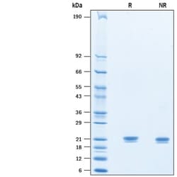 R D Systems Recombinant Mouse IFN-alpha 9 Protein 10 &mu;g | Buy Online | R&amp;D Systems&trade; | Fisher Scientific