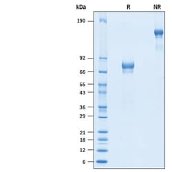 R D Systems Recombinant Cynomolgus/Rhesus IL-21R Fc Chimera Protein 100 &mu;g | Buy Online | R&amp;D Systems&trade; | Fisher Scientific