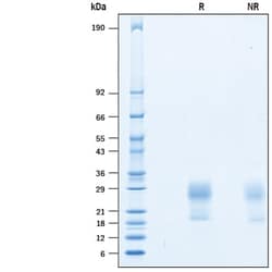 R&D Systems&trade;&nbsp;Recombinant Human IL-31 (HEK293-expressed) Protein