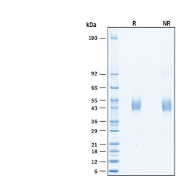 R&D Systems&trade;&nbsp;Recombinant Human KIR3DL3/CD158z His-tag Protein