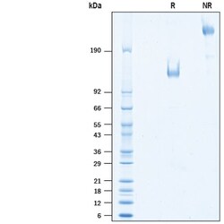 R&D Systems&trade;&nbsp;Recombinant Human TIM-1/KIM-1/HAVCR Fc Avi-tag Protein