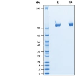 R&D Systems&trade;&nbsp;Recombinant Rat Tie-2 His-tag Protein