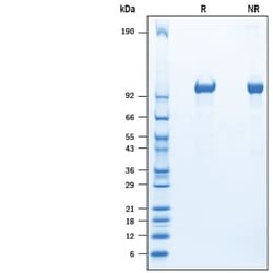 R&D Systems&trade;&nbsp;Recombinant Mouse Tie-2 His-tag Protein