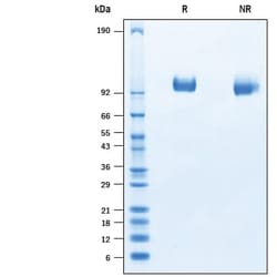 R&D Systems&trade;&nbsp;Recombinant Porcine Tie-2 His-tag Protein