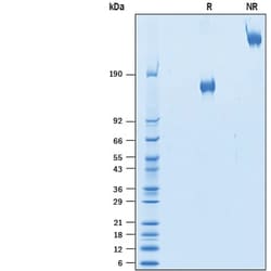 R&D Systems&trade;&nbsp;Recombinant Human VEGFR2/KDR/Flk-1 Fc Avi-tag Protein