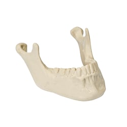 3B Scientific ORTHObones Model of Mandible with Teeth Mandible with teeth | Buy Online | 3B Scientific™ | Fisher Scientific