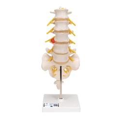 3B Scientific™ Lumbar Spinal Column Model - includes 3B Smart Anatomy