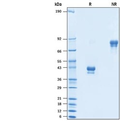 R D Systems Recombinant Human BCMA/TNFRSF17 Protein, Atto 488 Conjugate 20 &mu;g | Buy Online | R&amp;D Systems&trade; | Fisher Scientific