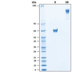 R&D Systems™ Recombinant Human VSTM2B Fc Chimera Avi-tag Protein