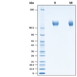 R&D Systems&trade;&nbsp;Recombinant Human ACE-2 His-tag Avi-tag Protein (CHO)