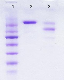Abcam&nbsp;Human IgE Protein, Full Length, Unconjugated, 1 mg