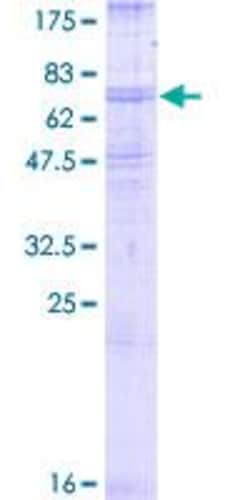 Abcam&nbsp;Recombinant Human Beta 2 Adrenergic Receptor Protein, Full Length, Wheat Germ, 2 &mu;g