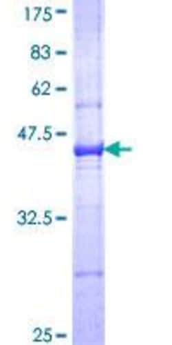 Abcam&nbsp;Recombinant Human C3 Protein, Wheat Germ, 10 &mu;g